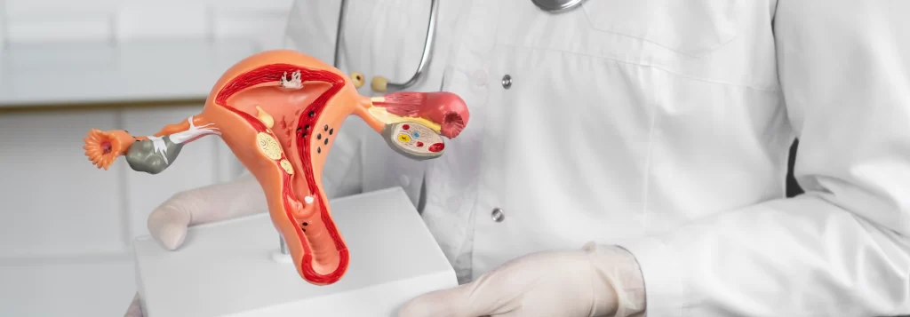 Biopsia de Endometrio – Agenda Médica